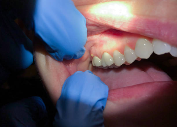 Best Pediatric Emergency Dentist in Hamilton, AL