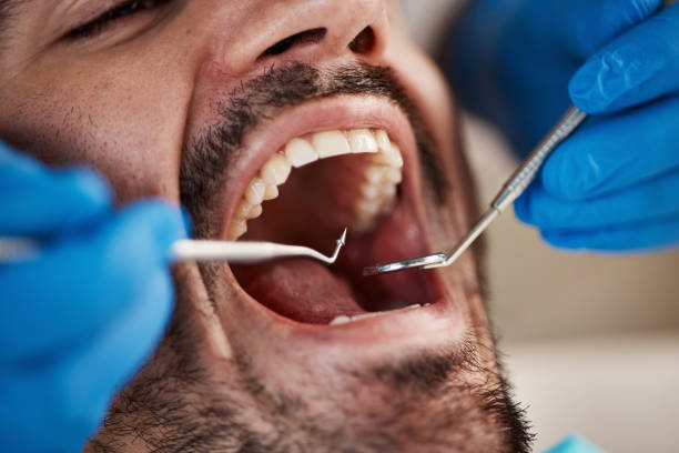 Best Emergency Dentist for Knocked-Out Tooth in Hamilton, AL