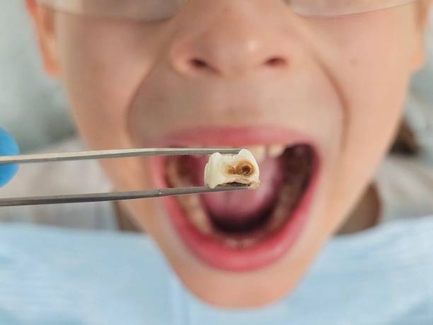 Best Mobile Emergency Dentist in Hamilton, AL